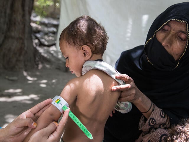Mazhda, 2, is measured using a MUAC bracelet while his grandmother holds him.