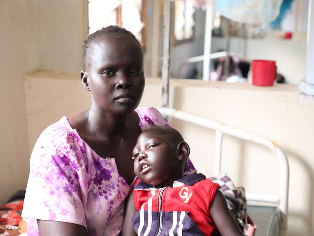 나야이안이 출산 도중 합병증으로 두부 기형으로 태어난 세살 아이 나이초를 돌보고 있습니다. 
