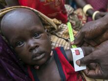 in South Sudan, a baby boy's arm is measured with a specially designed tape for signs of malnutrition.