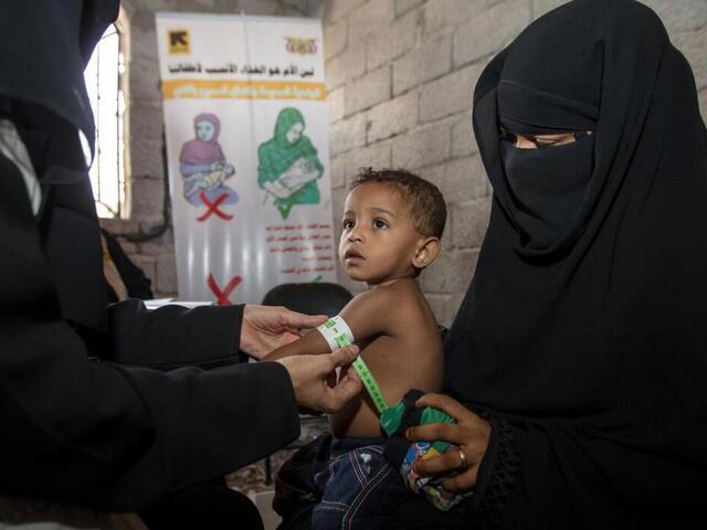 En pojke har en lyckad kontroll efter att ha behandlats för akut undernäring av ett mobilt RESCUE-sjukvårdsteam i Jemen