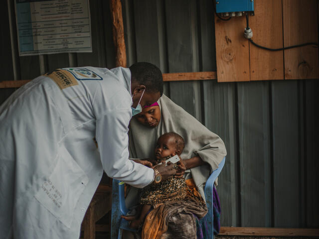 A doctor treats a 2 year-old Somali baby for malnourishment