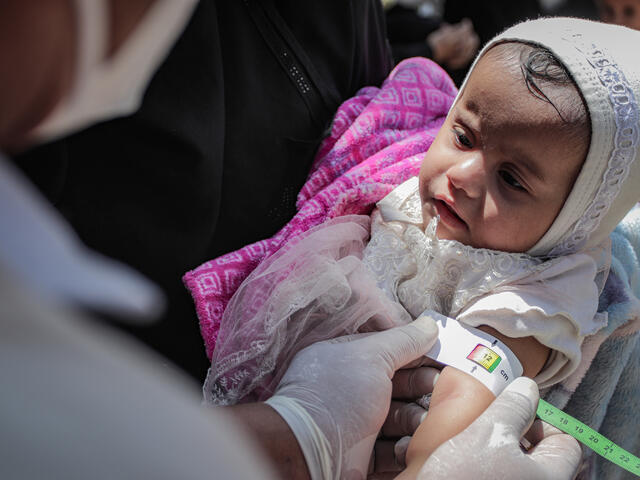 An IRC doctor screens a young child for signs of malnutrition by using a specialized tape to measure the child's arm.