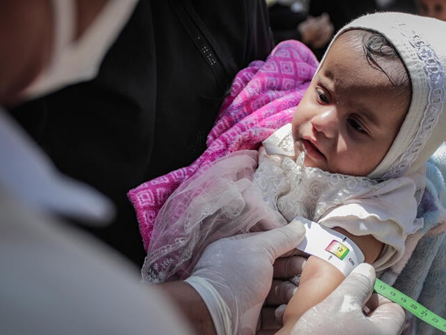 An IRC doctor screens a young child for signs of malnutrition by using a specialized tape to measure the child's arm.