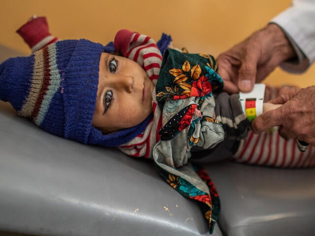In Afghanistan, a baby wearing a knit hat on an exam table has his upper arm measured with a special measuring tape to check for signs of malnutrition.