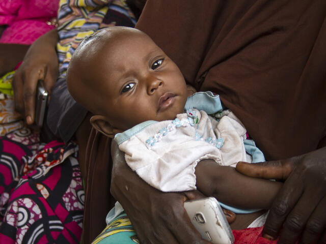 Six-month-year-old daughter Falmata, was diagnosed with severe malnutrition