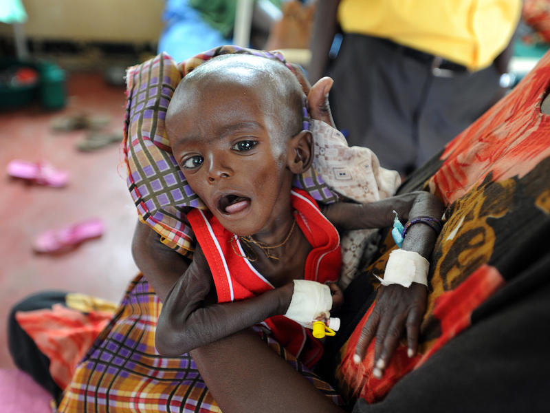 Face Of The Famine Baby Minhaj Before And After International Rescue Committee Irc Its popularity with unicef and other relief agencies along with what many see as nutriset's aggressive protection of the patent for the product have not only spurred debate but also a. international rescue committee