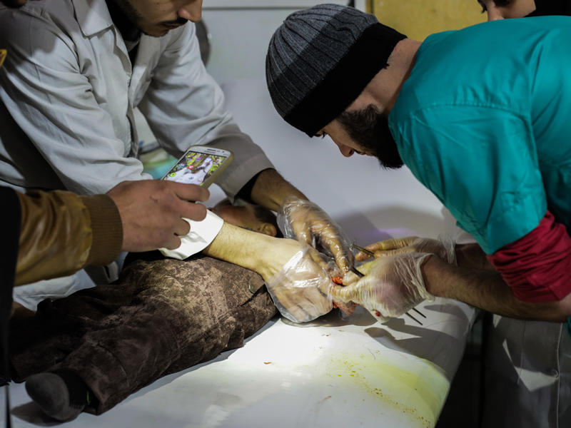 A doctor who works at a hospital in Eastern Ghouta treats a toddler's wounds A doctor who works at a hospital in Eastern Ghouta treats a toddler's wounds