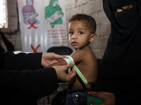 A baby's upper arm is measured for signs of malnutrition by an IRC health worker 