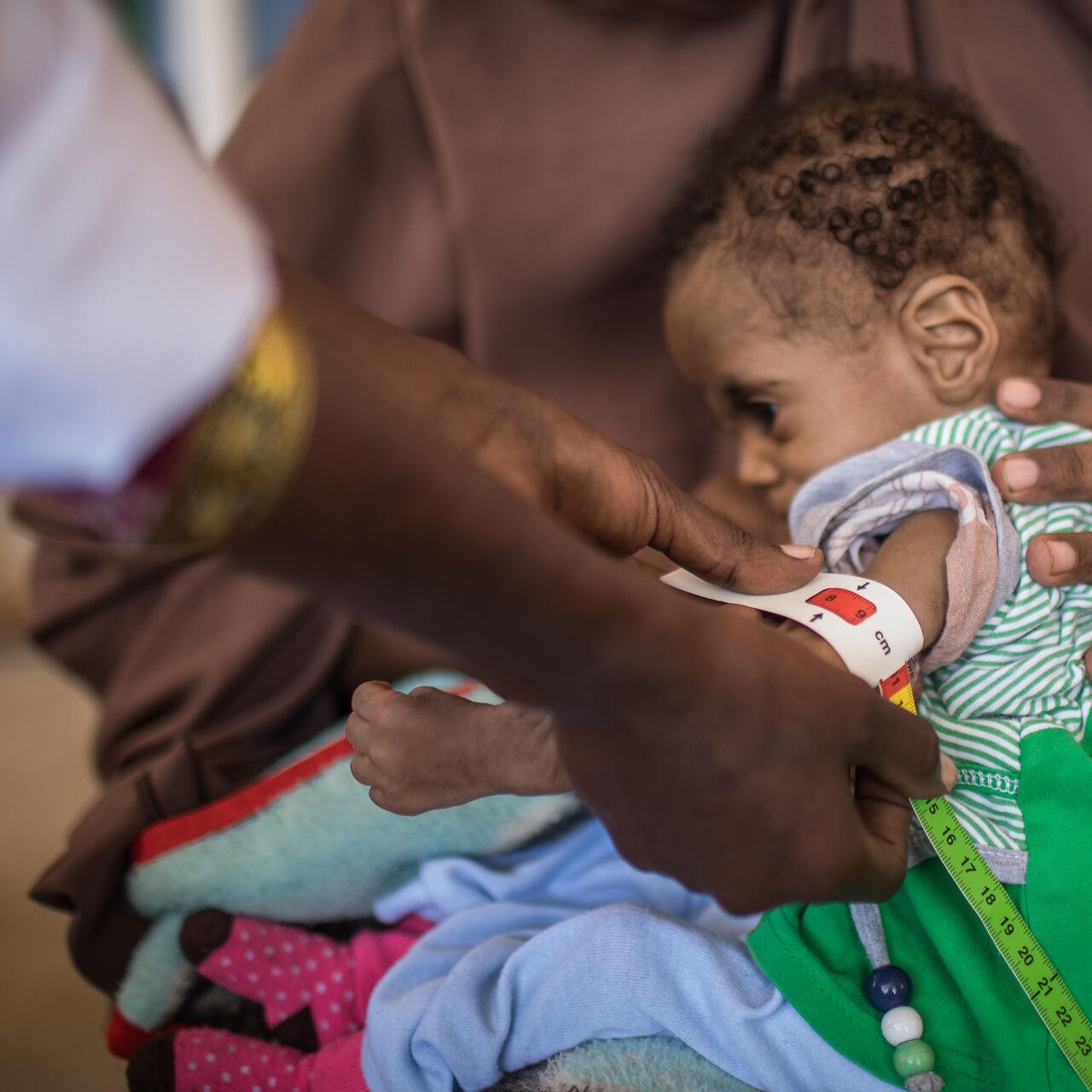 A young Somalian child is examined for nutrition