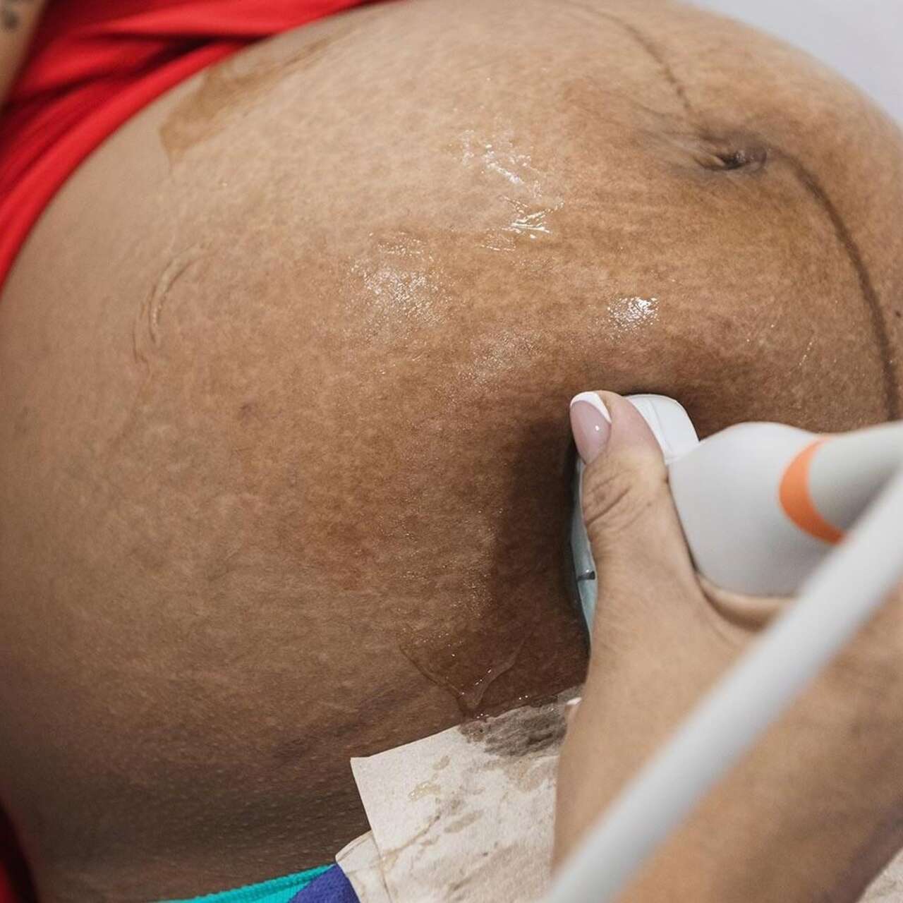 A pregnant woman on her back getting an echography.
