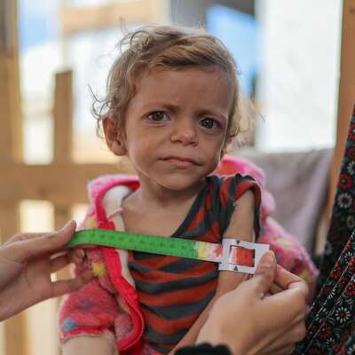 Gaza, Palestine. 3-year-old child being treated for malnutrition. She is having her arm measured with MUAC tape to assess her level of malnutrition.