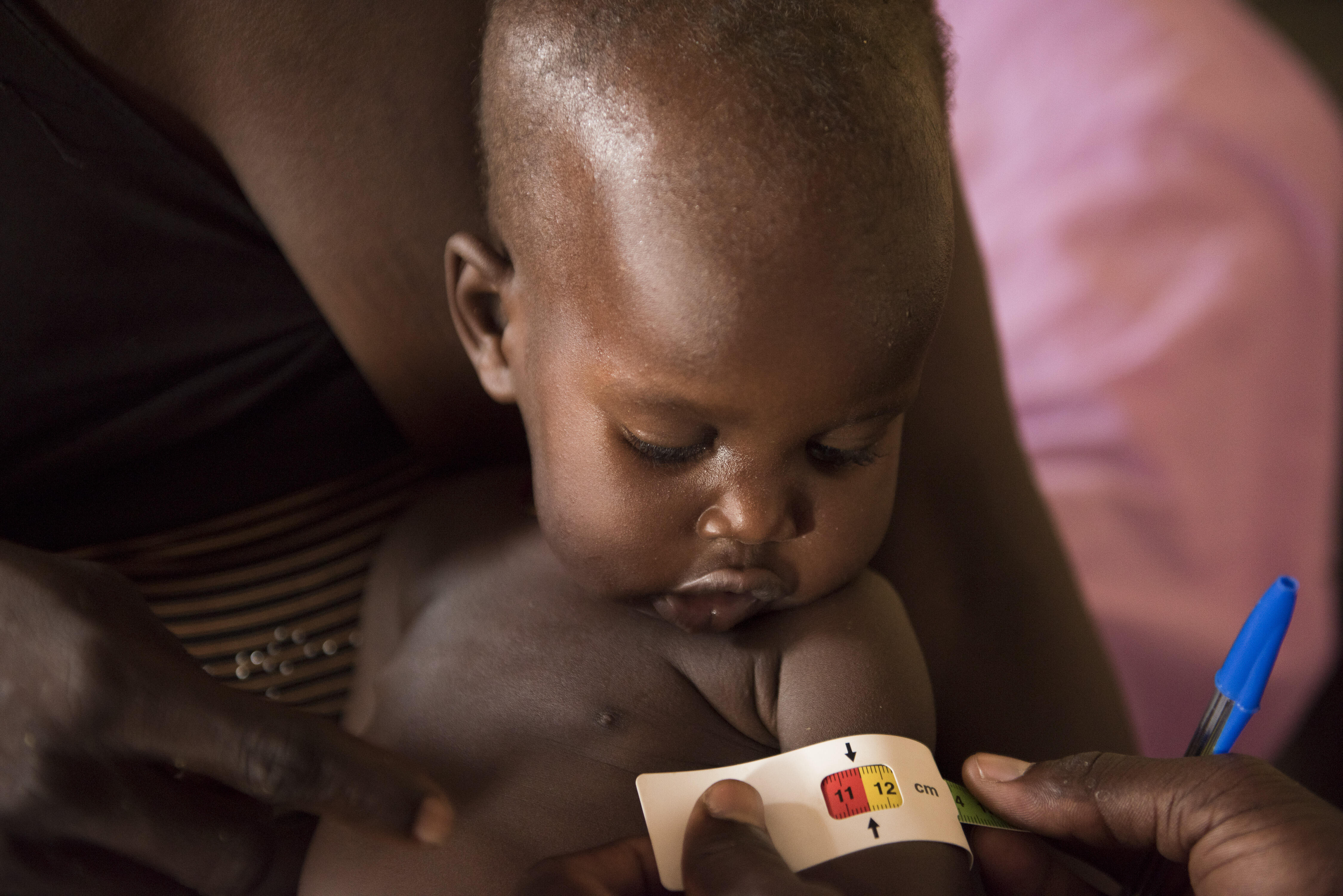A health worker has placed a MUAC measuring tape around a South Sudanese baby's upper arm. The tape shows that he is at risk of acute malnutrition.