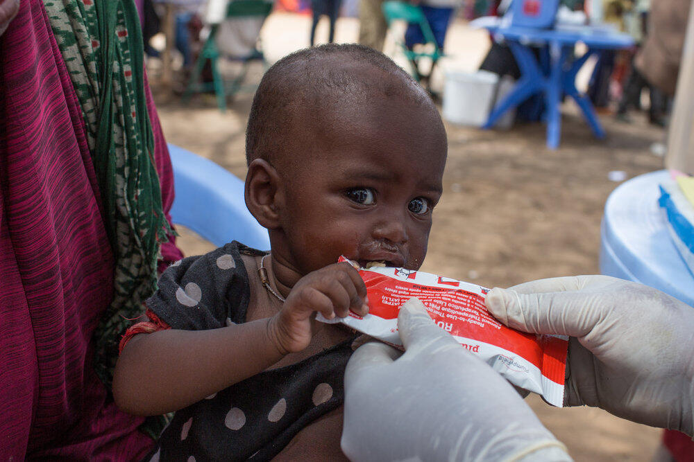 A toddler being treated for malnutrition eats a nutrient-rich peanut butter food