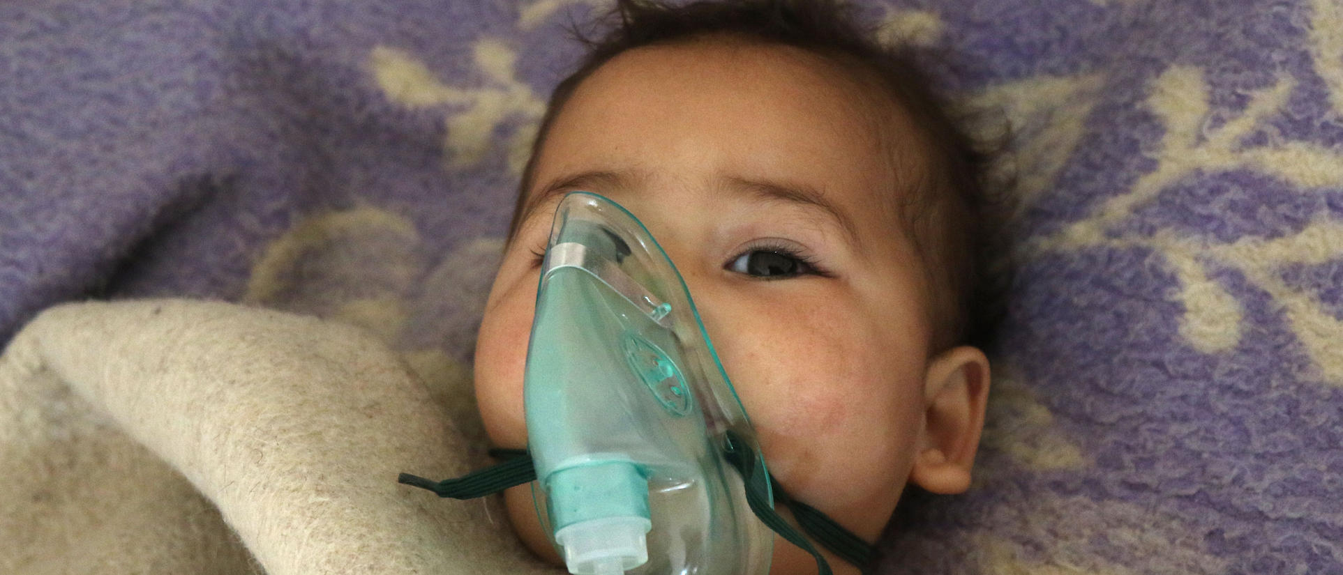 A baby injured in a chemical weapons attack in Idlib, Syria wears an oxygen mask while undergoing treatment