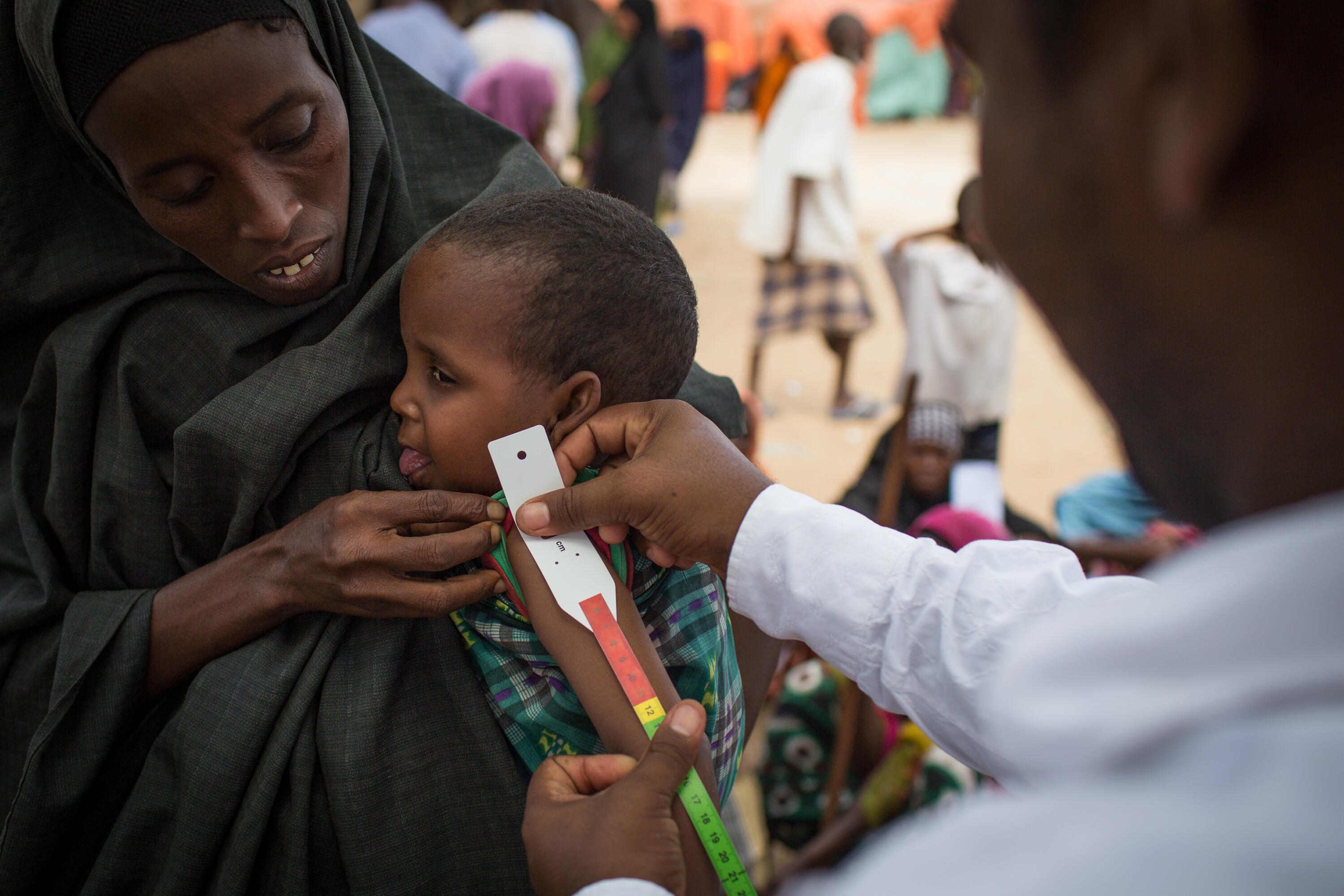 A child is screened for malnutrition using an arm curcumference measurement at an IRC clinic near Mogadishu