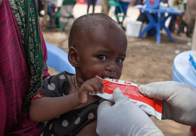 A Somali baby eats nutritious peanut paste from a packet at an IRC health clinic treating children for malnutrition.
