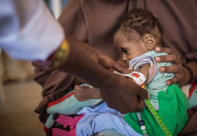 소말리아의 국제구조위원회 클리닉에서 영양실조의 징후에 대해 딸의 상부 팔이 측정됩니다.