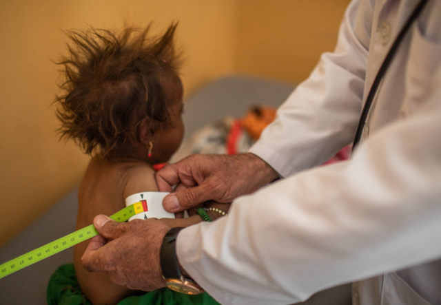 A baby faces away from the camera while being tested for malnutrition. The tape around her arm is red, indicating that malnutrition is present.