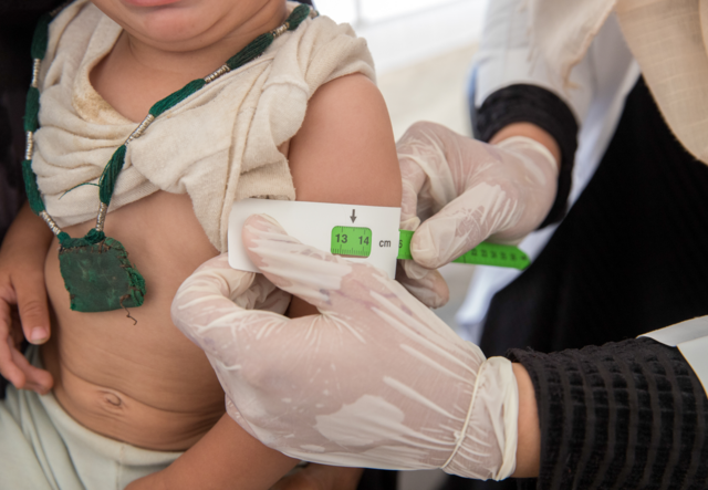 A girl is measured with tape around her arm to see if she is suffering from malnutrition