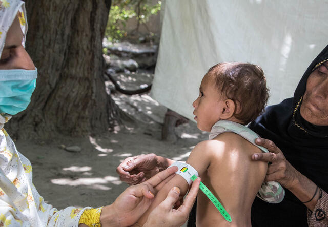 Riaz Bibi는 어린 손주 중 한 명을 안고 있습니다. 아이는 영양 상담사가 팔 둘레를 측정하는 것을 지켜보고 있습니다.