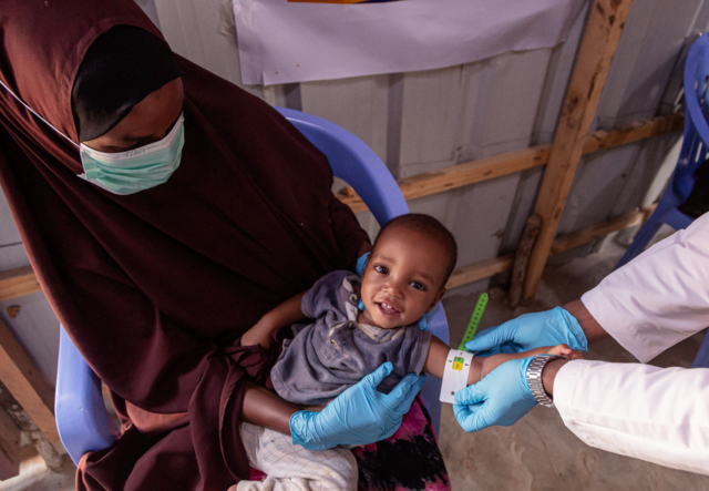 A young boy is screened for signs of malnutrition at an internally displaced persons camp in Mogadishu.