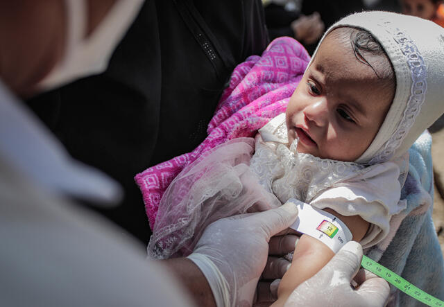 An IRC doctor screens a young child for signs of malnutrition by using a specialized tape to measure the child's arm.