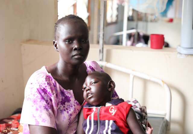 나야이안이 출산 도중 합병증으로 두부 기형으로 태어난 세살 아이 나이초를 돌보고 있습니다. 