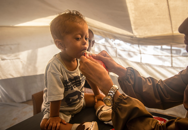 En liten pojke får behandling mot undernäring av RESCUE i Gaza City.