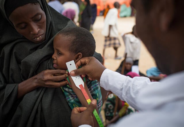 모가디슈 외곽 캠프에서 한 의료 종사자가 영양실조의 징후를 확인하기 위해 아이의 팔을 측정합니다.