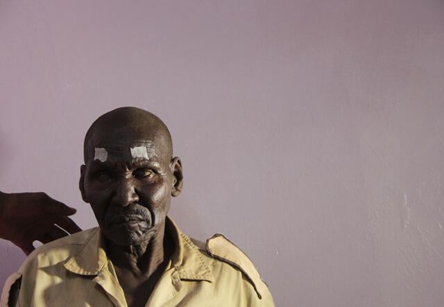 67-year-old Logilae was blind for three years. The cataract surgery he had to restore his eyesight took just 10 minutes. Living outside of the camp, he travelled for two days to be able to get the surgery he needed. Now he’s able to see again, he has plan