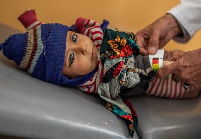 A young child is screened for malnutrition at a health clinic supported by the IRC in Afghanistan
