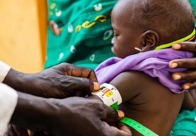 Staff at an International Rescue Committee health center in Chad measure a baby's upper arm with a special armband that can help diagnose acute malnutrition.