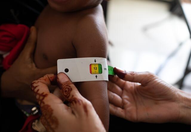 An International Rescue Commitee health woker uses a specially marked armband to measure a baby's upper arm for signs of acute malnutrition.