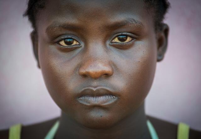 A 2014 close-up of 15-year-old Melissa looking directly into the camera with a serious expression.