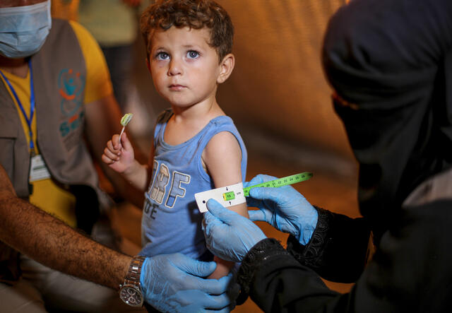 A small boy holds a lollipop and receives care from two people wearing gloves and masks.