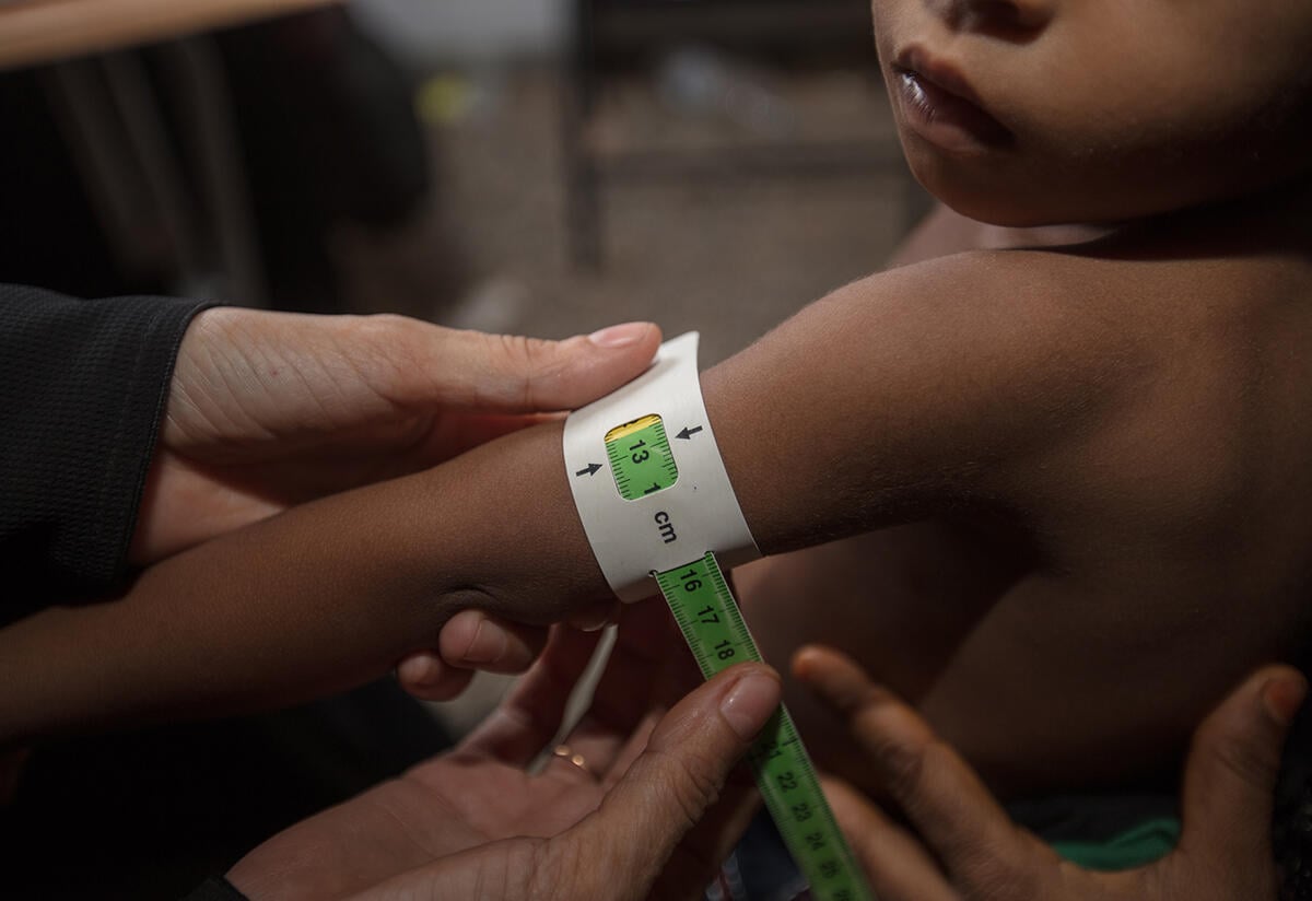 Closeup of a health worker measuring a child's upper arm circumference while checking for signs of malnutrition.