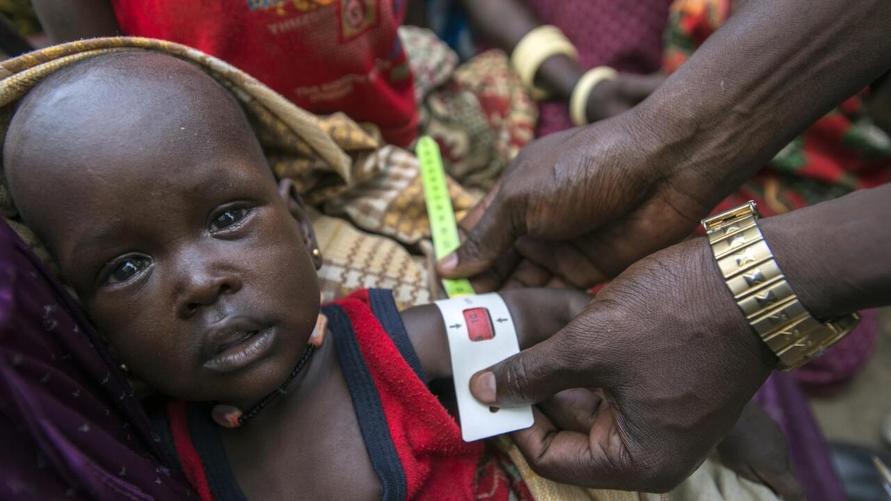 IRC urges immediate action to address alarming rise in malnutrition cases threatening refugees in Kenyan Camps - Vimarsana News