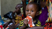 Barn behandlas för undernäring av RECSUE i Tchad