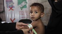 Ein Junge wird in einer mobilen IRC-Klinik in Jemen behandelt