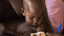 Barn undersökd för undernäring i Sydsudan av RESCUE