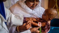 A health worker in Somalia measures a baby's upper arm with a special measuring tape to check for signs of malnutrition.