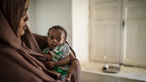 A mother stands holding her malnourished 10-month-old daughter at an IRC clinic in Somalia.