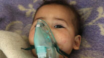 Baby on a ventilator.