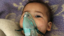 A small child injured in a suspected chemical gas attack in Idlib, Syria receives treatment  with an oxygen mask