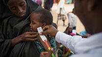 A child is screened for malnutrition at an IRC clinic in a camp near Mogadishu, Somalia