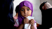 A young girl in Yemen being treated for acute malnutrition eats a peanut butter based nutritional paste. 