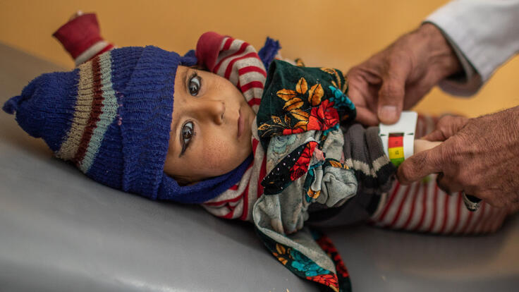 Baby Habib being screened for malnutrition.