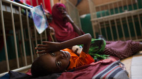 A young boy with severe acute malnutrition receives treatment at the Banadir District Hospital in Mogadishu, Somalia.