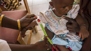 Six-month-year-old Falmata Usman with severe malnutrition
