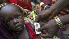 in South Sudan, a baby boy's arm is measured with a specially designed tape for signs of malnutrition.